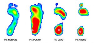 tipos_huella_pies